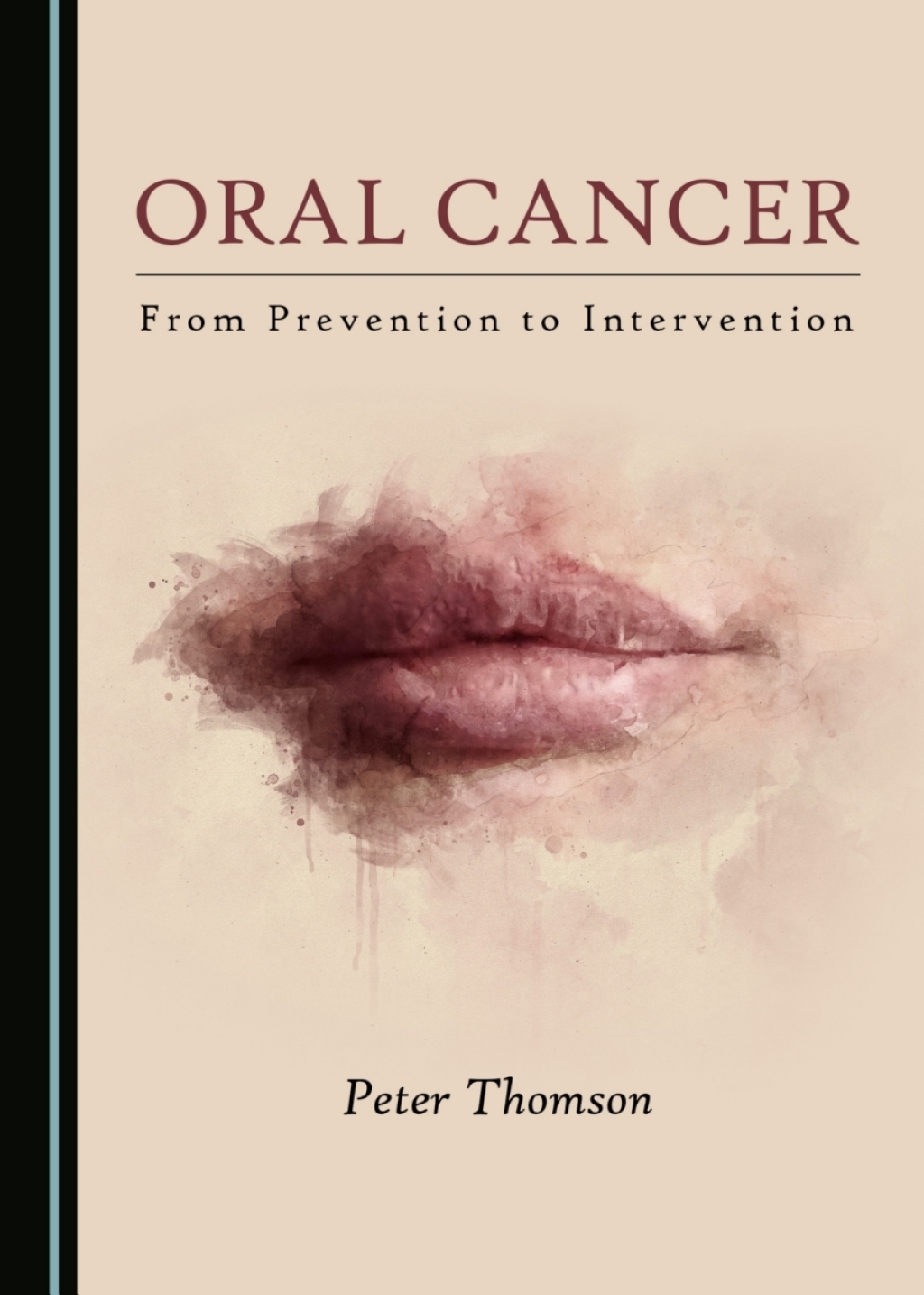 Oral Cancer From Prevention to Intervention 1st Edition â€“ PDF/EPUB Version Downloadable