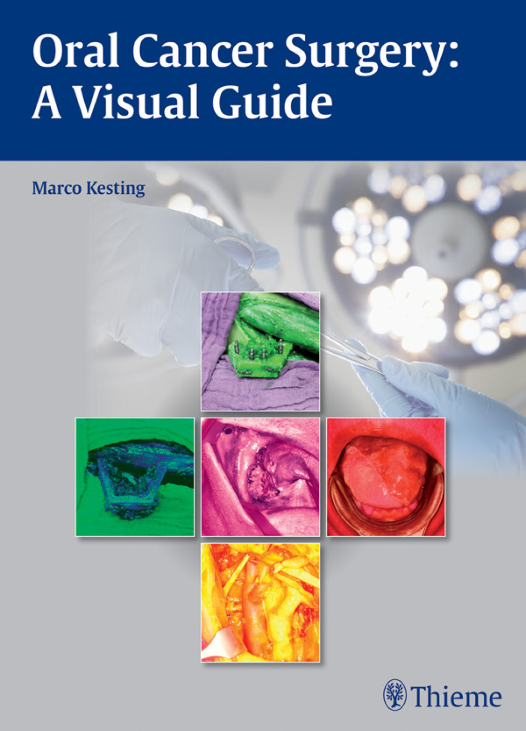Oral Cancer Surgery A Visual Guide 1st Edition â€“ PDF/EPUB Version Downloadable