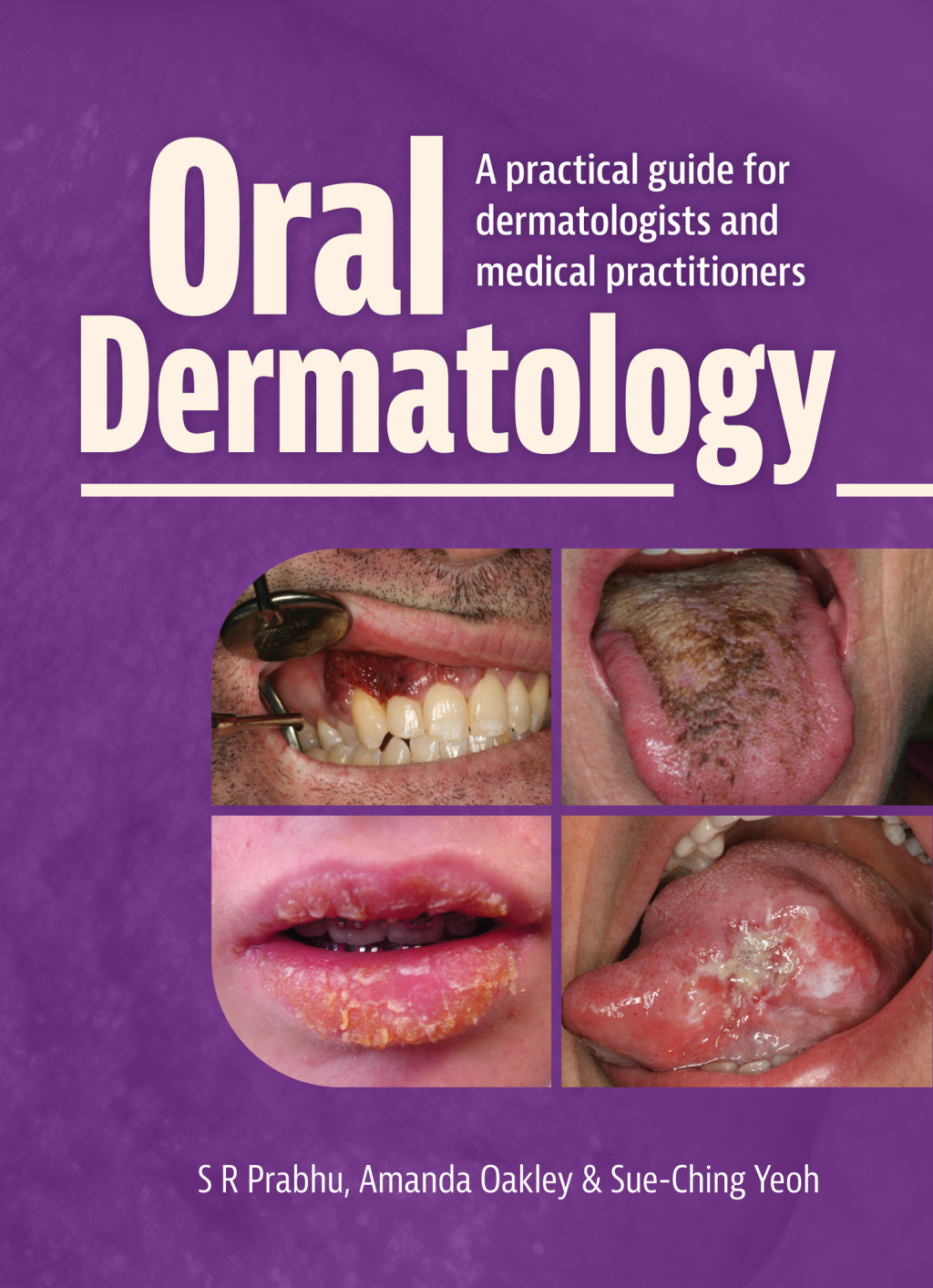 Oral Dermatology A practical guide for dermatologists and medical practitioners  â€“ PDF/EPUB Version Downloadable