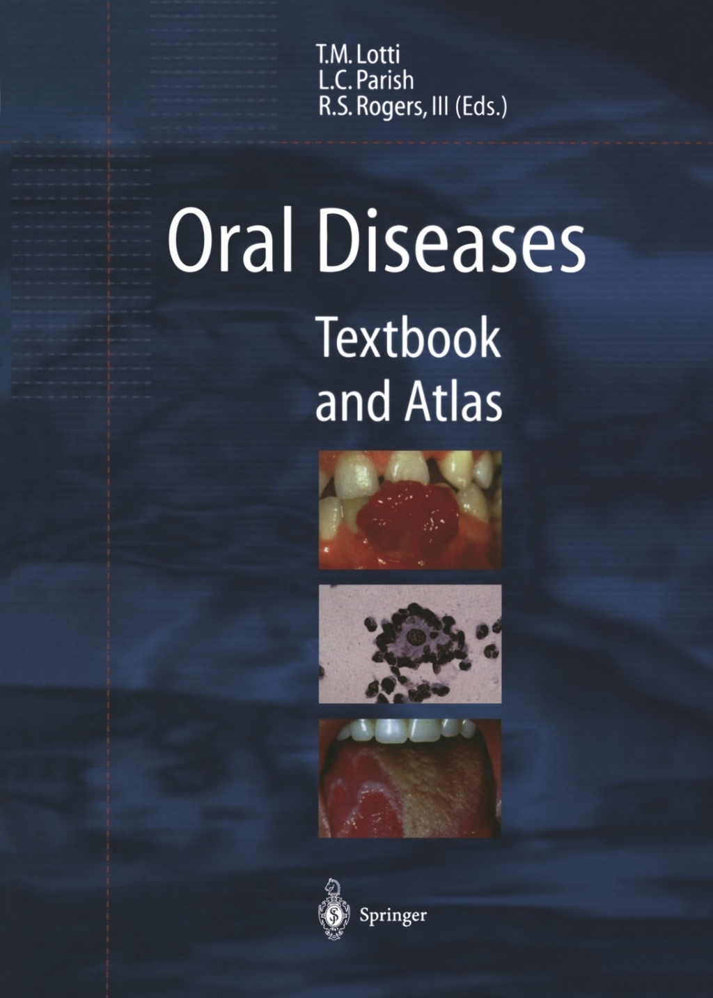 Oral Diseases Textbook and Atlas 1st Edition â€“ PDF/EPUB Version Downloadable