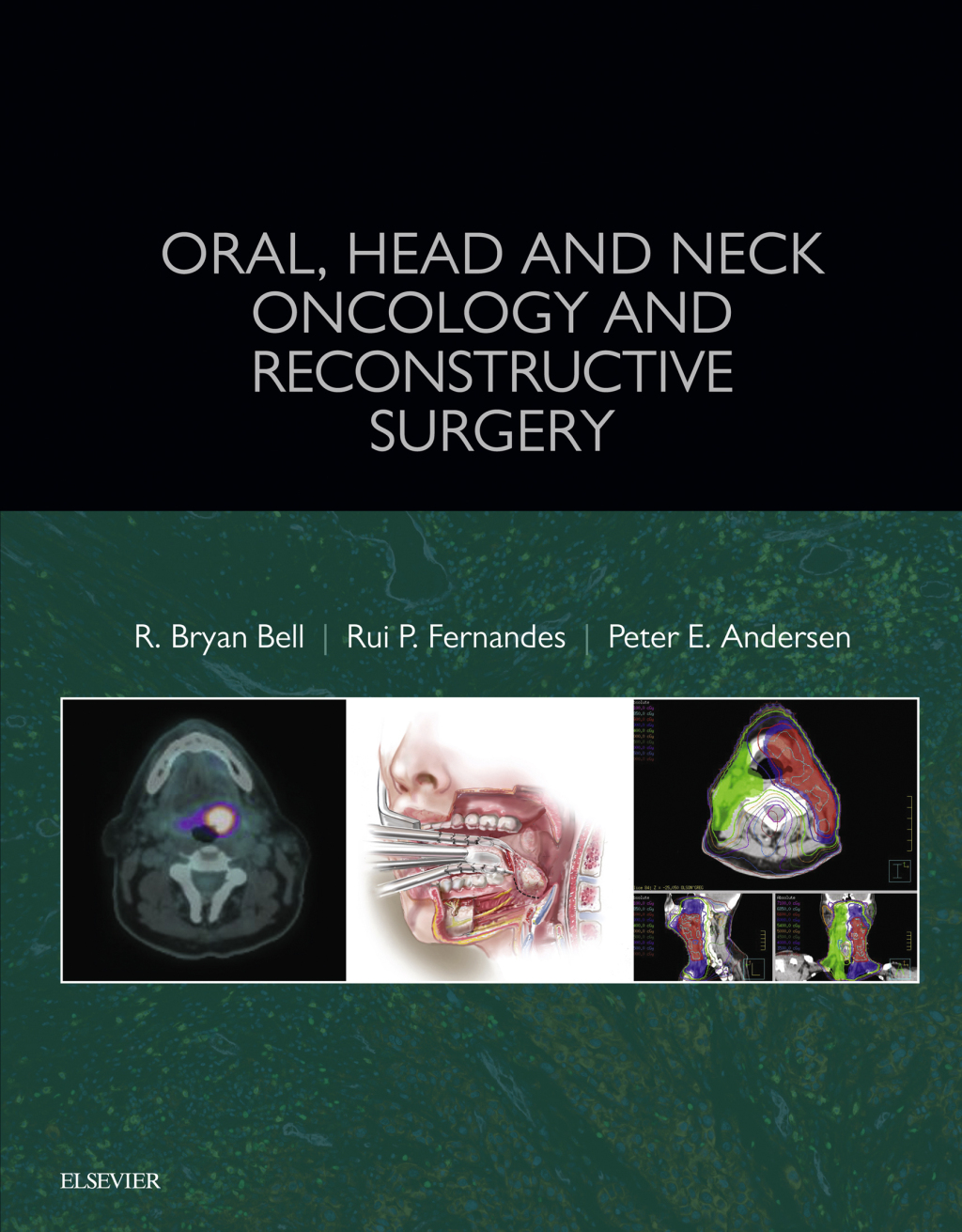 Oral, Head and Neck Oncology and Reconstructive Surgery 1st Edition â€“ PDF/EPUB Version Downloadable