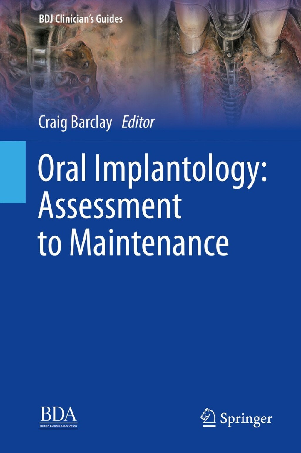Oral Implantology: Assessment to Maintenance  â€“ PDF/EPUB Version Downloadable