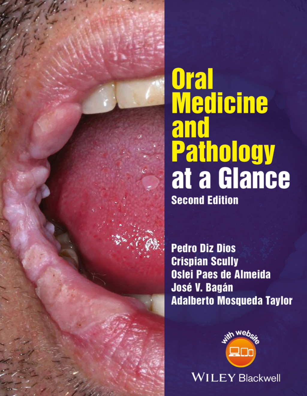 Oral Medicine and Pathology at a Glance 2nd Edition â€“ PDF/EPUB Version Downloadable