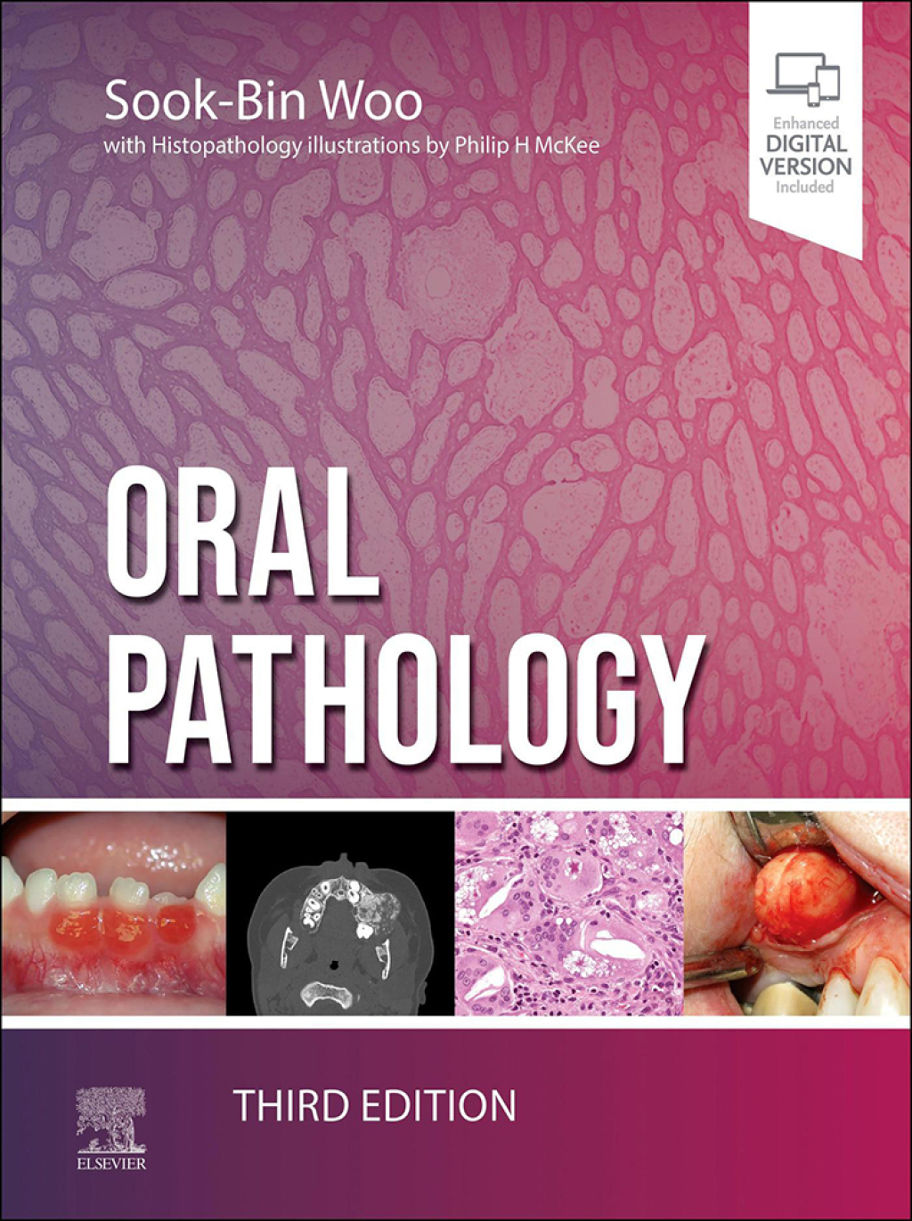 Oral Pathology 3rd Edition â€“ PDF/EPUB Version Downloadable