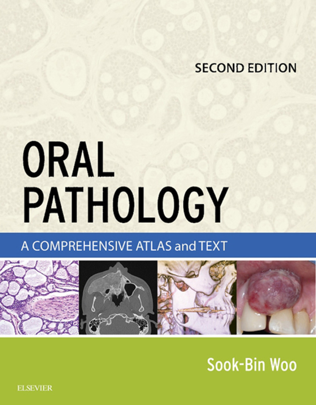 Oral Pathology A Comprehensive Atlas and Text 2nd Edition â€“ PDF/EPUB Version Downloadable