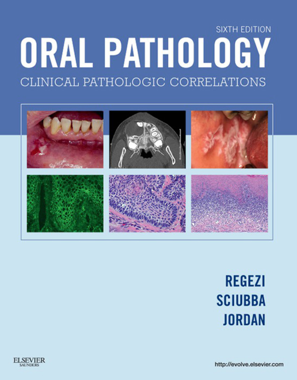 Oral Pathology Clinical Pathologic Correlations 6th Edition â€“ PDF/EPUB Version Downloadable