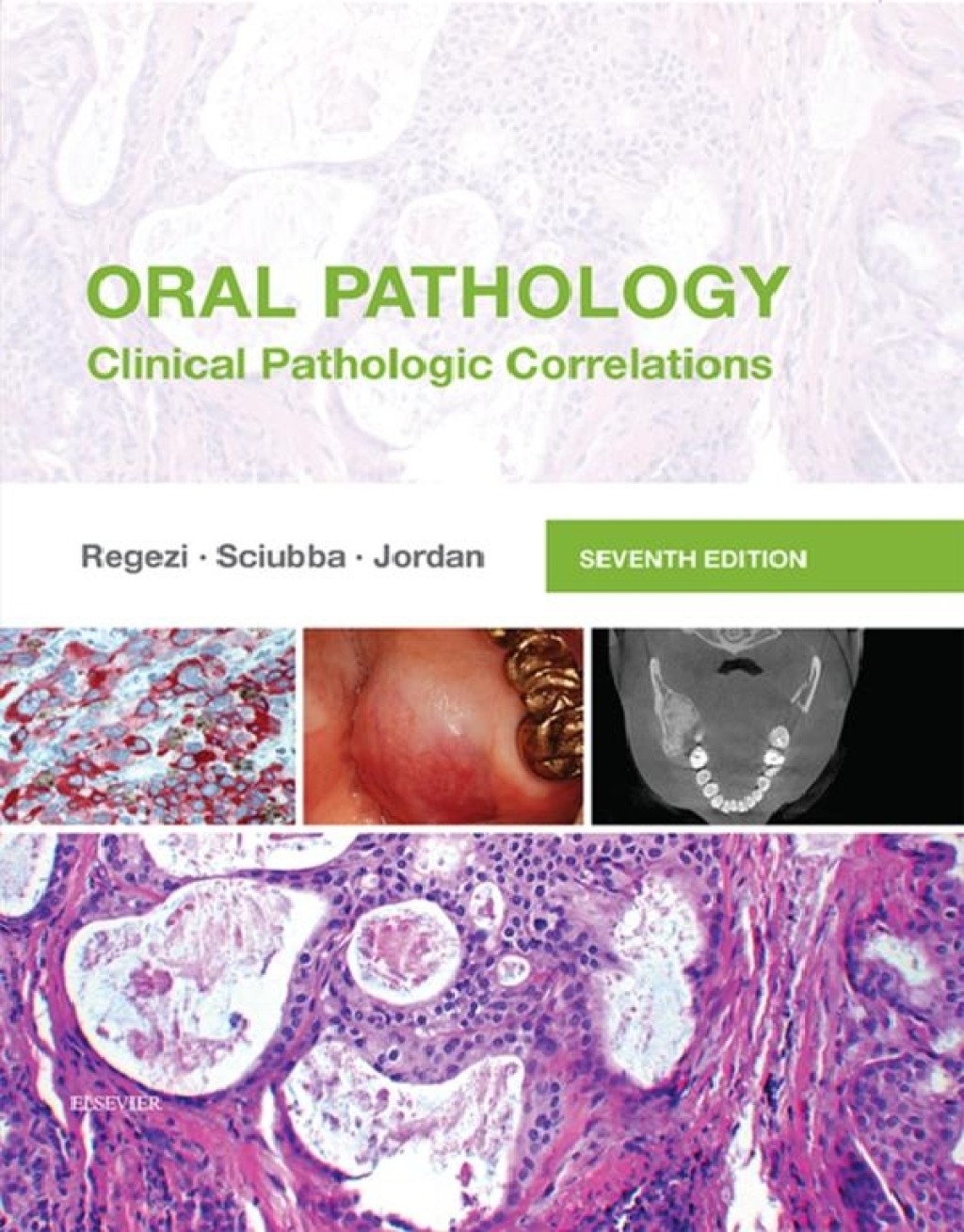 Oral Pathology: Clinical Pathologic Correlations 7th Edition â€“ PDF/EPUB Version Downloadable