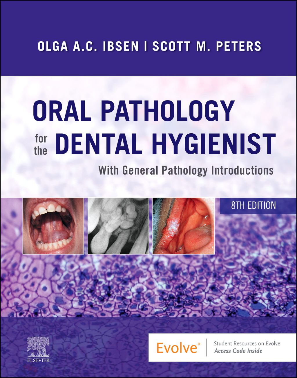 Oral Pathology for the Dental Hygienist 8th Edition â€“ PDF/EPUB Version Downloadable