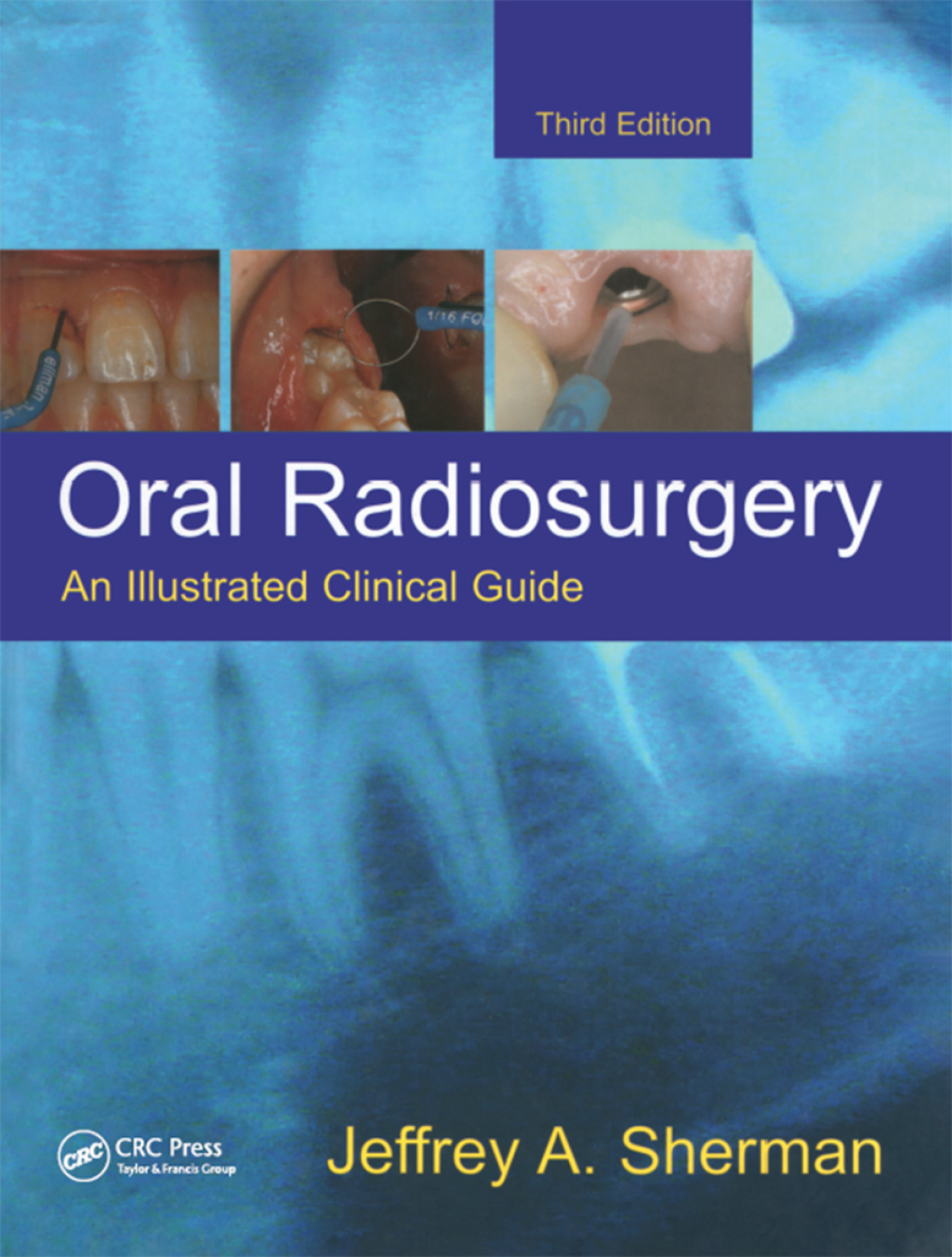 Oral Radiosurgery An Illustrated Clinical Guide 3rd Edition â€“ PDF/EPUB Version Downloadable
