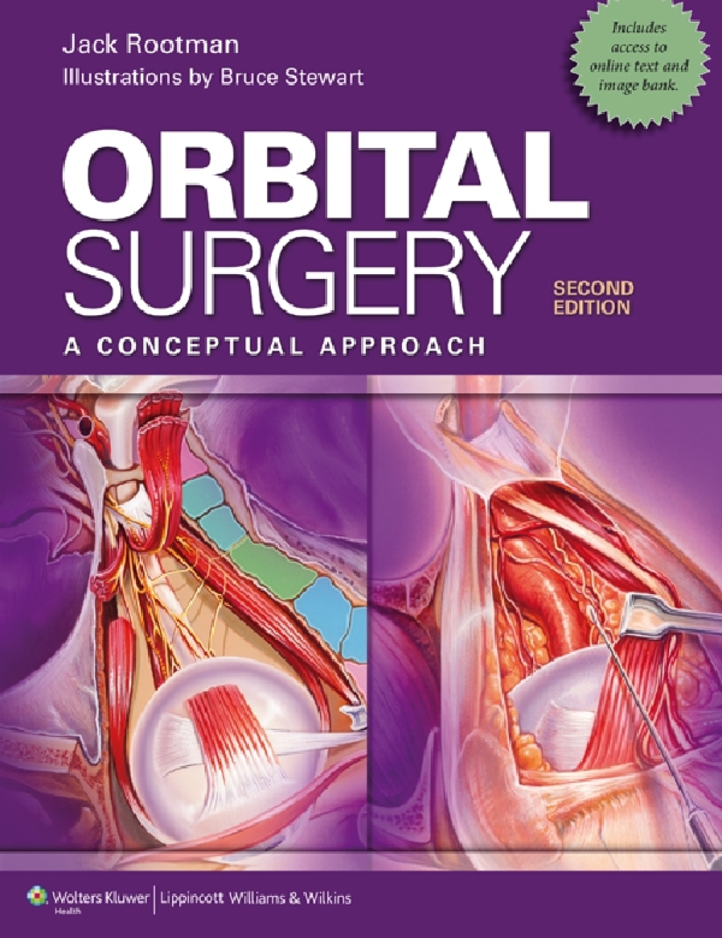 Orbital Surgery A Conceptual Approach 2nd Edition â€“ PDF/EPUB Version Downloadable