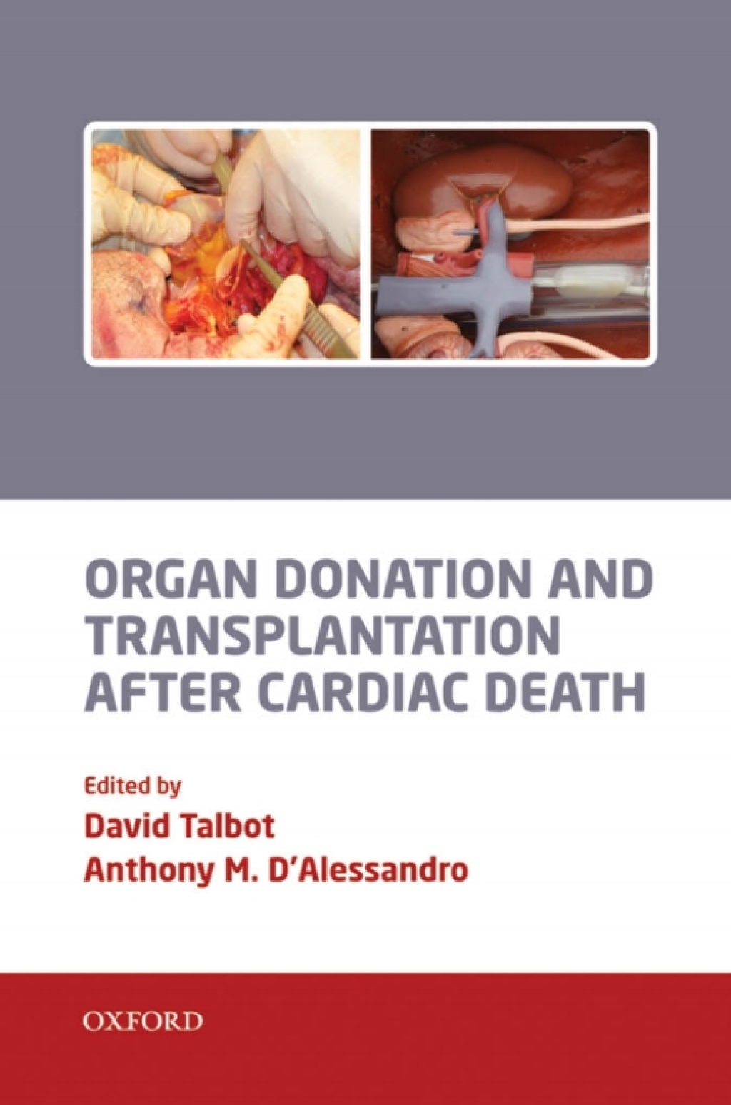 Organ Donation and Transplantation after Cardiac Death 1st Edition â€“ PDF/EPUB Version Downloadable