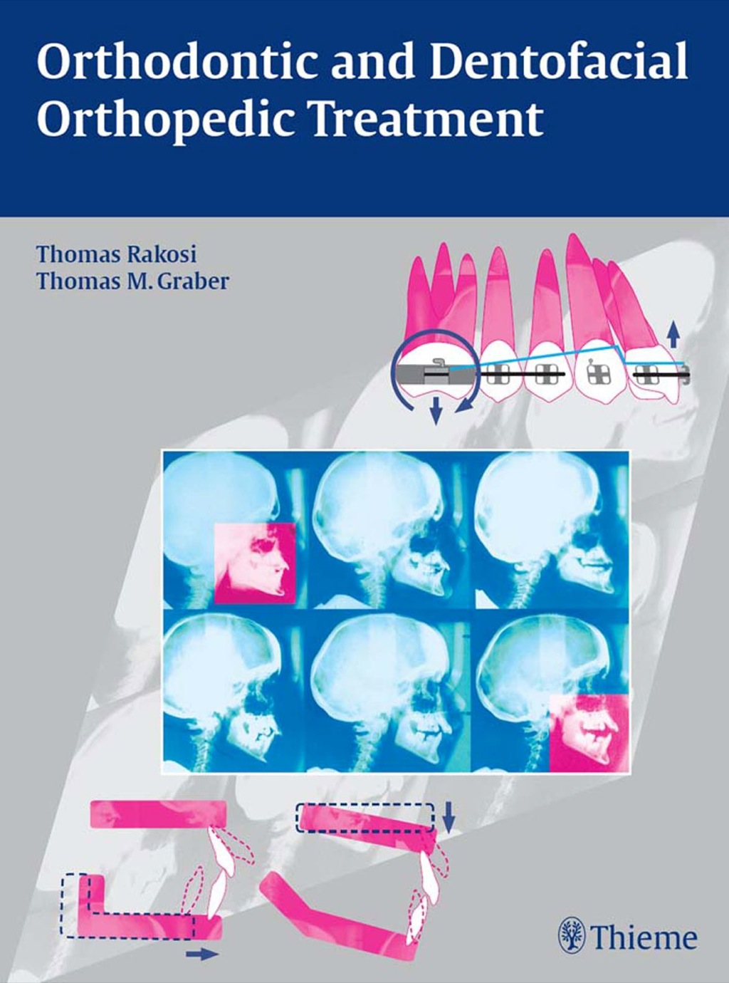 Orthodontic and Dentofacial Orthopedic Treatment 1st Edition â€“ PDF/EPUB Version Downloadable