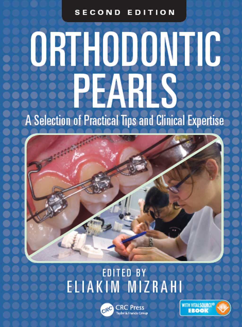 Orthodontic Pearls A Selection of Practical Tips and Clinical Expertise, Second Edition 2nd Edition – PDF/EPUB Version Downloadable Orthodontic Pearls A Selection of Practical Tips and Clinical Expertise, Second Edition 2nd Edition – PDF/EPUB Version Downloadable - Image 1