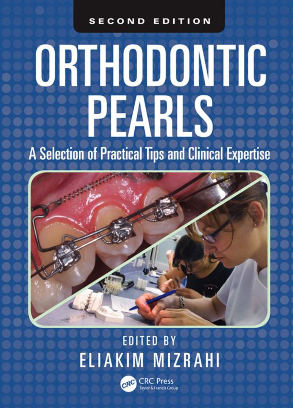 Orthodontic Pearls A Selection of Practical Tips and Clinical Expertise, Second Edition 2nd Edition â€“ PDF/EPUB Version Downloadable