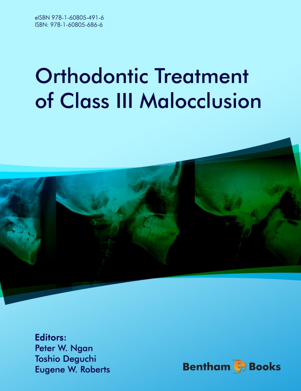 Orthodontic Treatment of Class III Malocclusion 1st Edition â€“ PDF/EPUB Version Downloadable