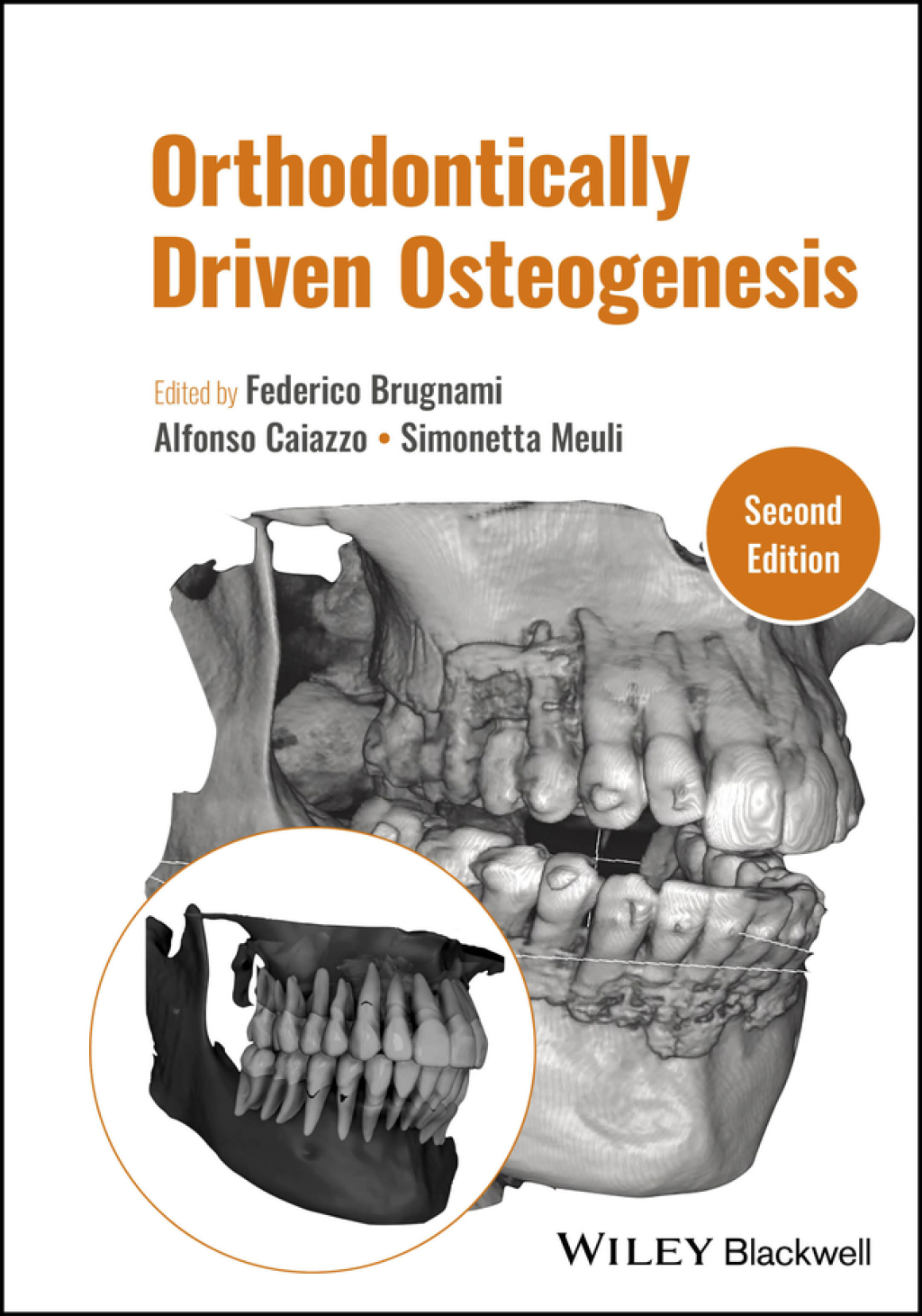 Orthodontically Driven Osteogenesis 2nd Edition â€“ PDF/EPUB Version Downloadable