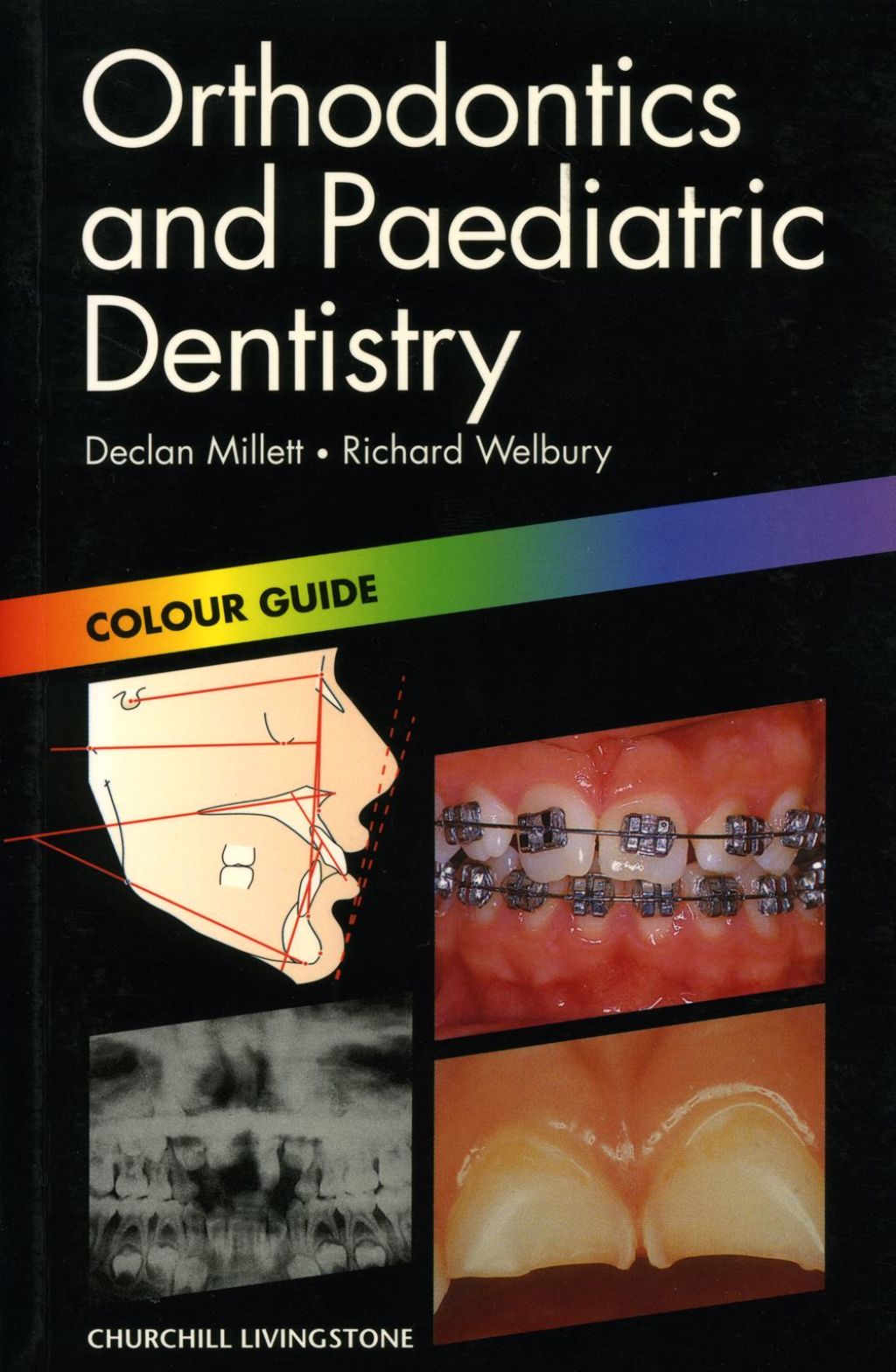 Orthodontics and Paediatric Dentistry 1st Edition â€“ PDF/EPUB Version Downloadable