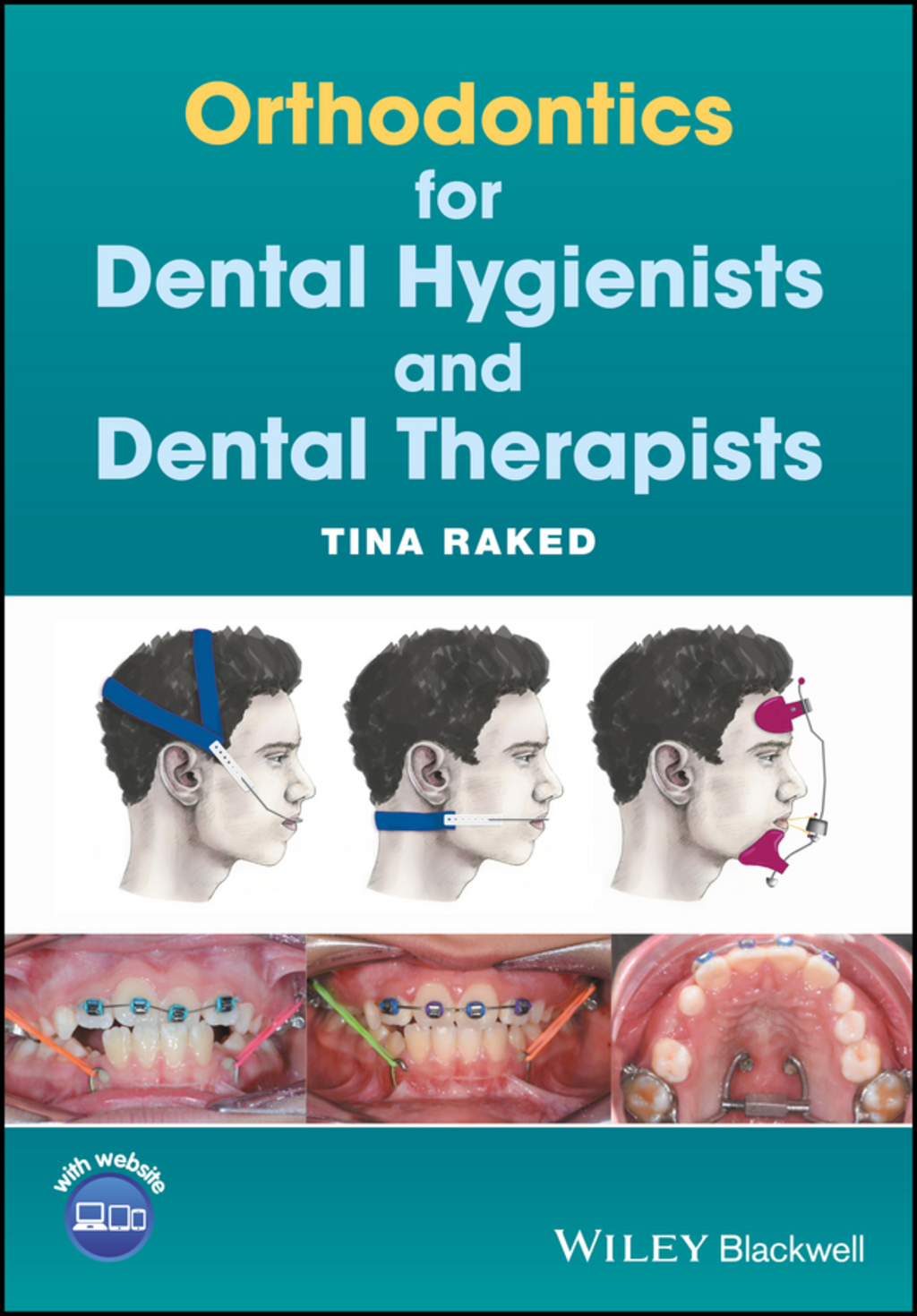 Orthodontics for Dental Hygienists and Dental Therapists 1st Edition - (PDF/EPUB Version)