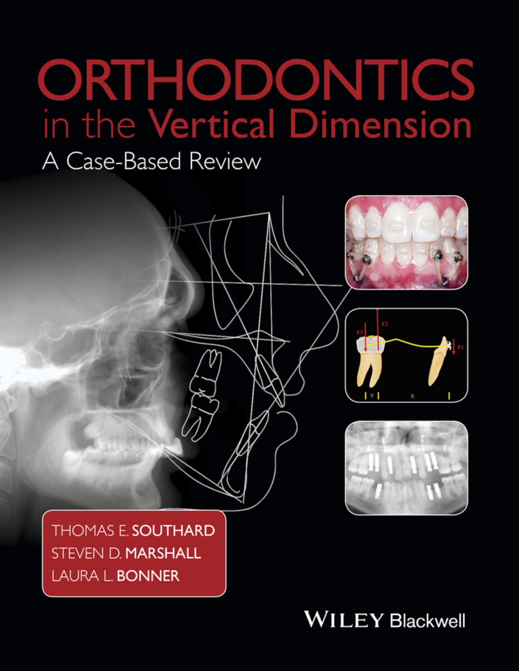 Orthodontics in the Vertical Dimension: A Case-Based Review 1st Edition â€“ PDF/EPUB Version Downloadable