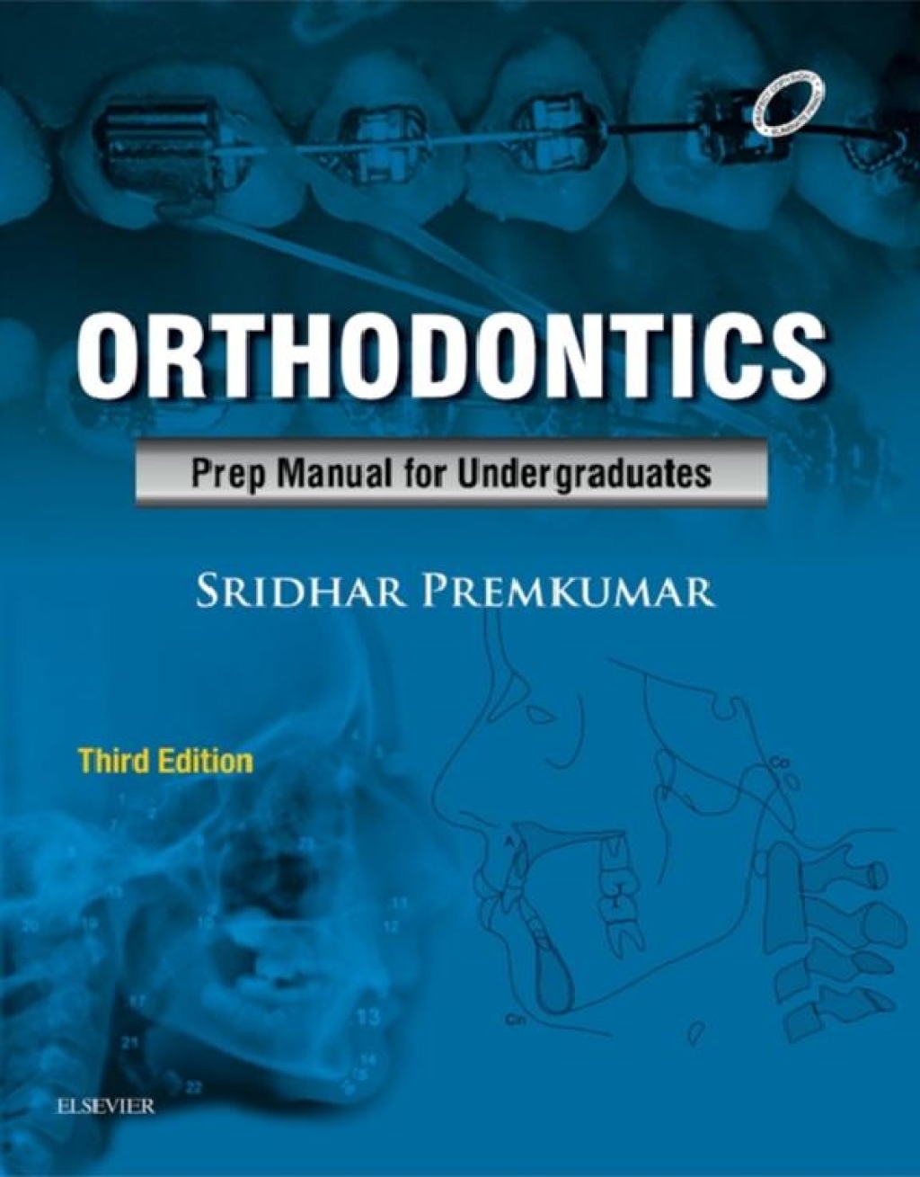 Orthodontics: Preparatory Manual for Undergraduates 3rd Edition - (PDF/EPUB Version)