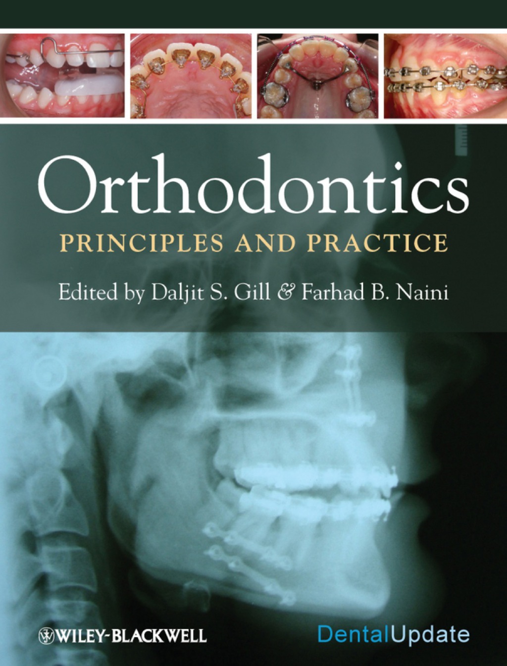 Orthodontics: Principles and Practice 1st Edition â€“ PDF/EPUB Version Downloadable