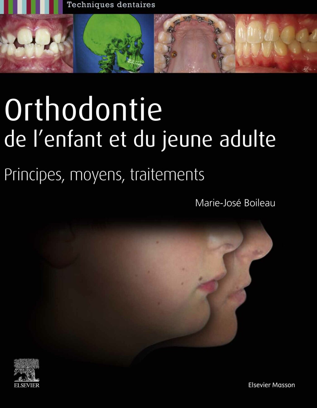 Orthodontie de l'enfant et du jeune adulte Principes, moyens, traitements 1st Edition â€“ PDF/EPUB Version Downloadable