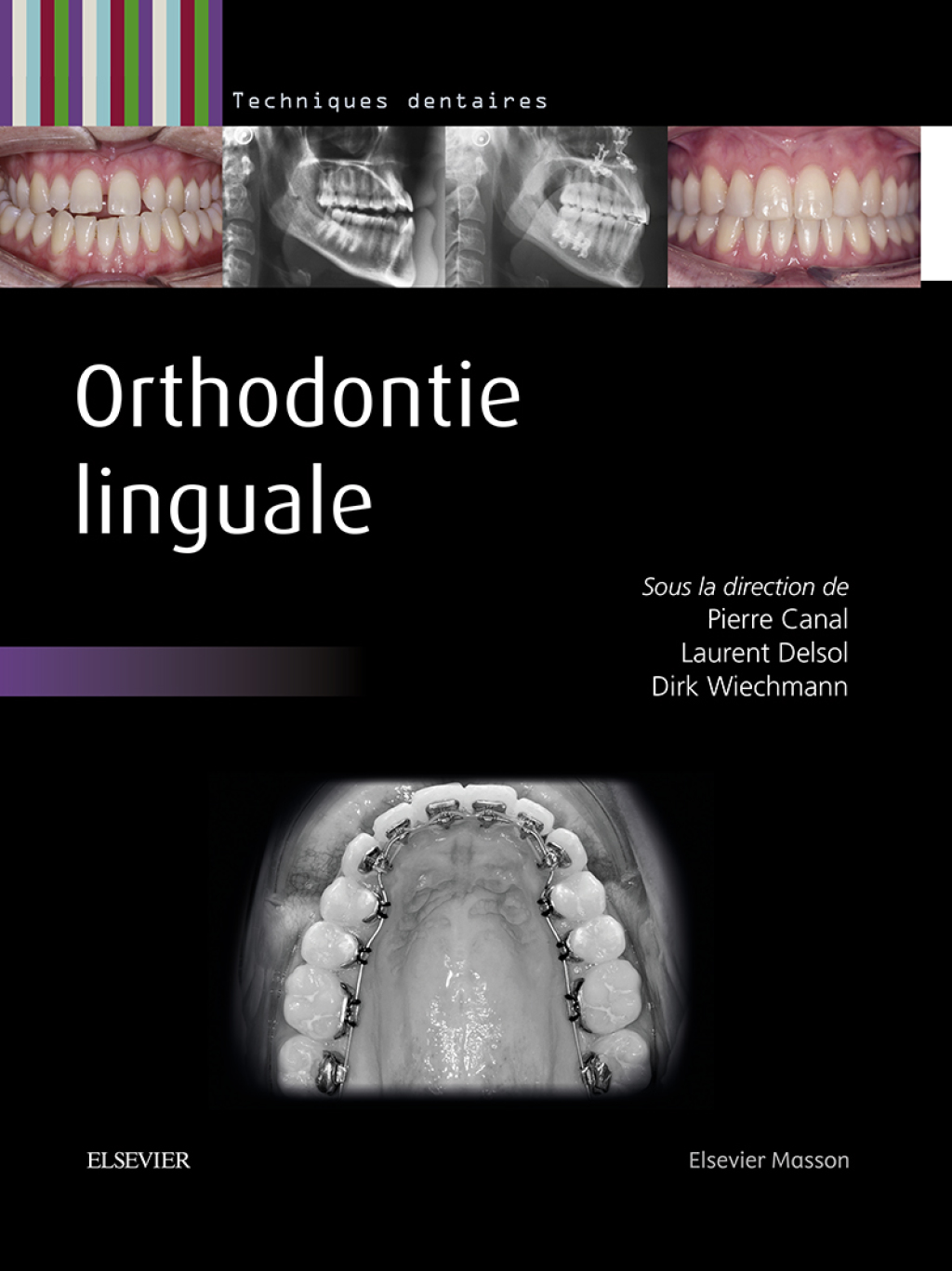 Orthodontie linguale  â€“ PDF/EPUB Version Downloadable