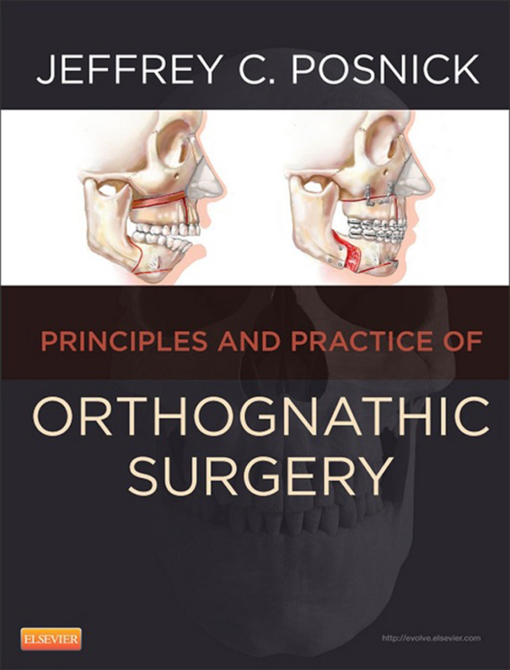 Orthognathic Surgery  â€“ PDF/EPUB Version Downloadable
