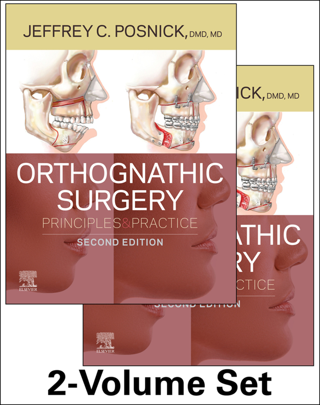 Orthognathic Surgery - 2 Volume Set Principles and Practice 2nd Edition â€“ PDF/EPUB Version Downloadable