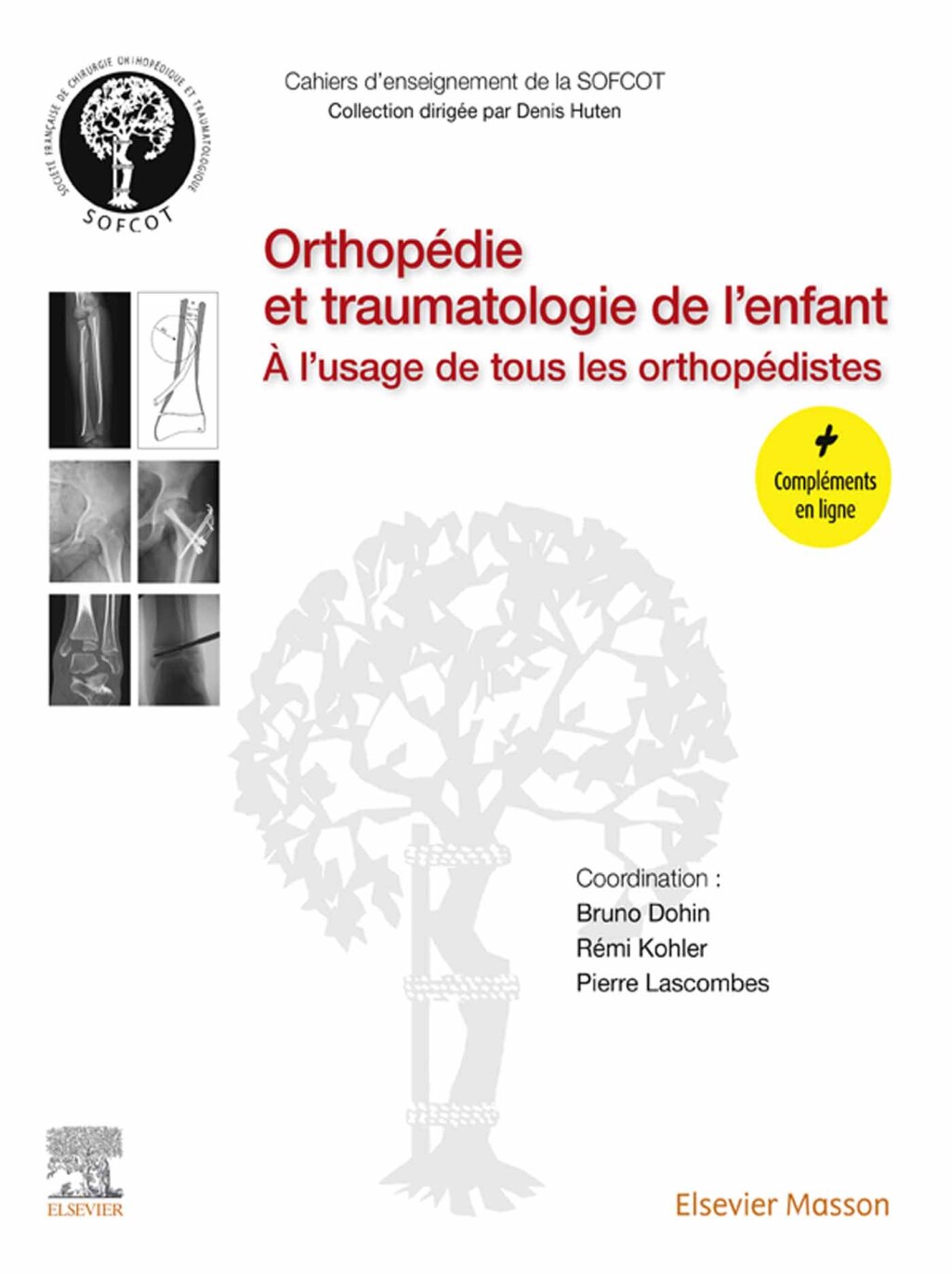 OrthopÃ©die et traumatologie de l'enfant Ã€ l'usage de tous les orthopÃ©distes  â€“ PDF/EPUB Version Downloadable