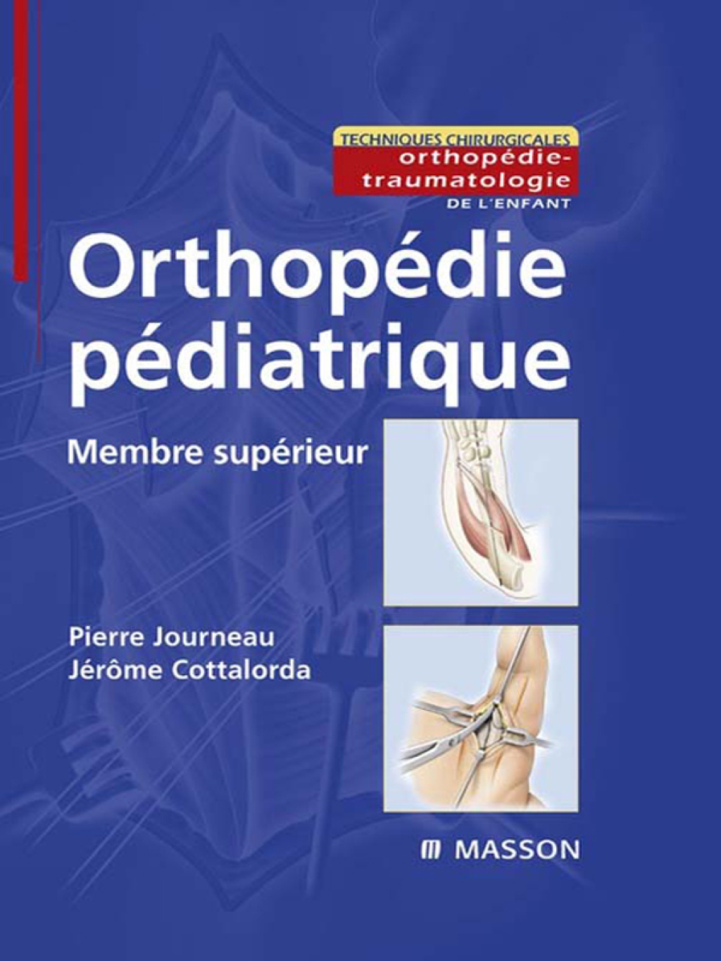 OrthopÃ©die pÃ©diatrique - Membre supÃ©rieur  â€“ PDF/EPUB Version Downloadable