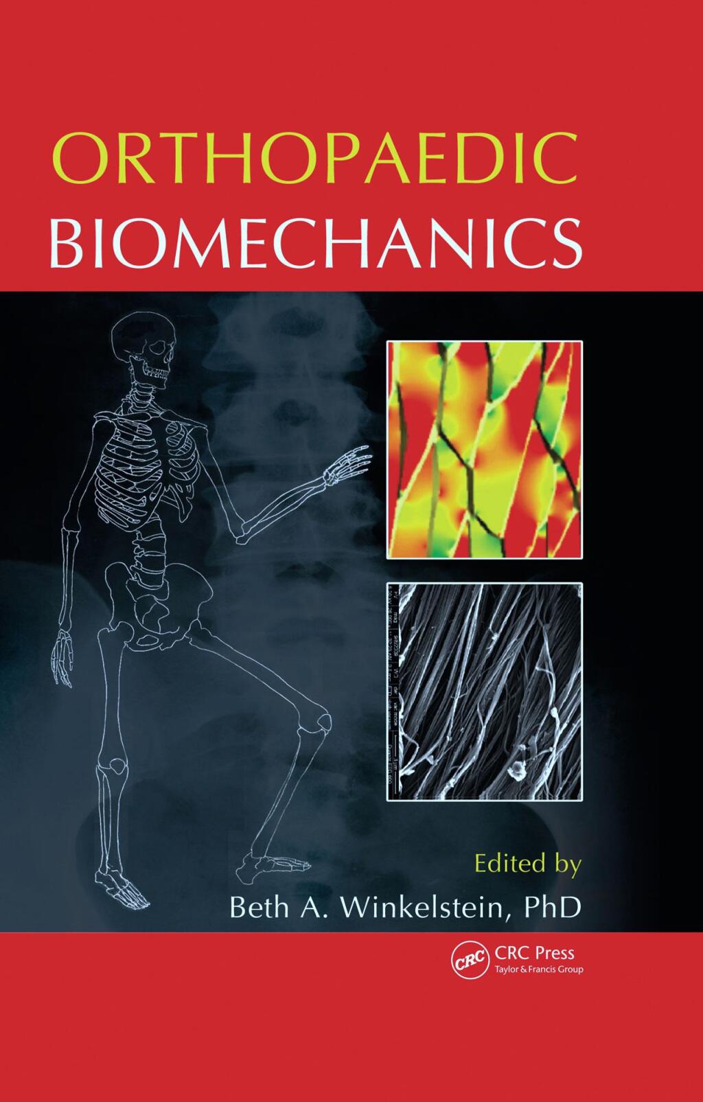 Orthopaedic Biomechanics 1st Edition â€“ PDF/EPUB Version Downloadable