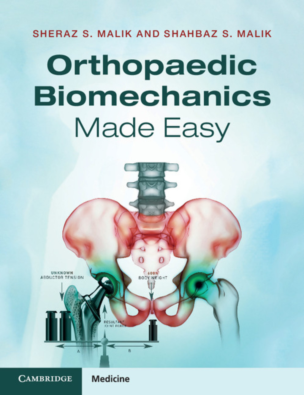 Orthopaedic Biomechanics Made Easy 1st Edition â€“ PDF/EPUB Version Downloadable