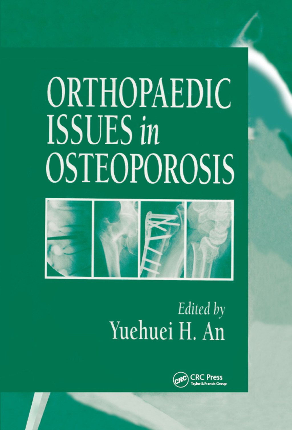Orthopaedic Issues in Osteoporosis 1st Edition â€“ PDF/EPUB Version Downloadable