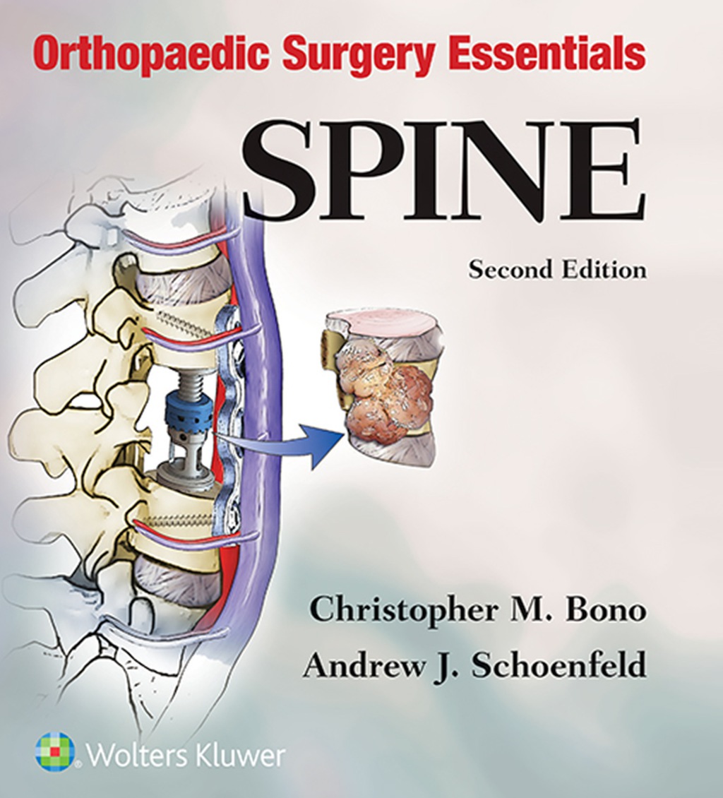 Orthopaedic Surgery Essentials: Spine 2nd Edition â€“ PDF/EPUB Version Downloadable