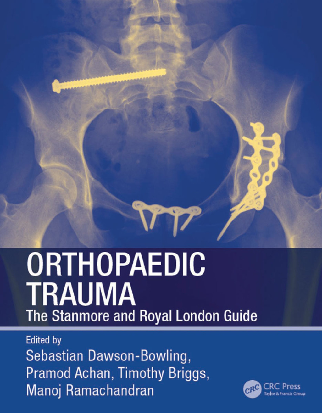 Orthopaedic Trauma The Stanmore and Royal London Guide 1st Edition â€“ PDF/EPUB Version Downloadable