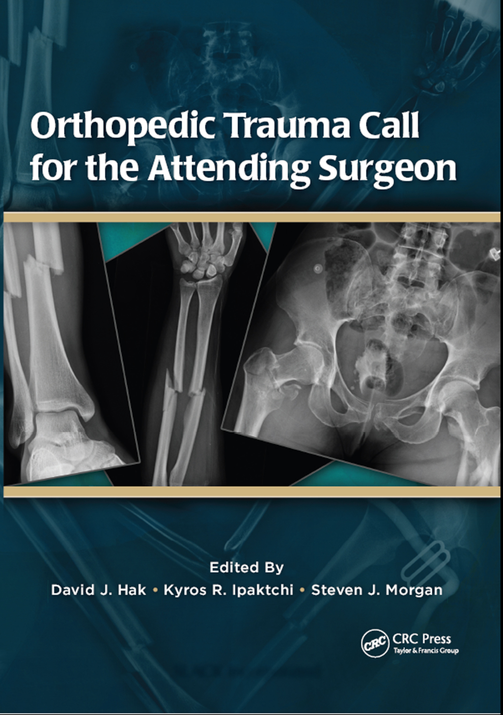 Orthopedic Trauma Call for the Attending Surgeon 1st Edition â€“ PDF/EPUB Version Downloadable