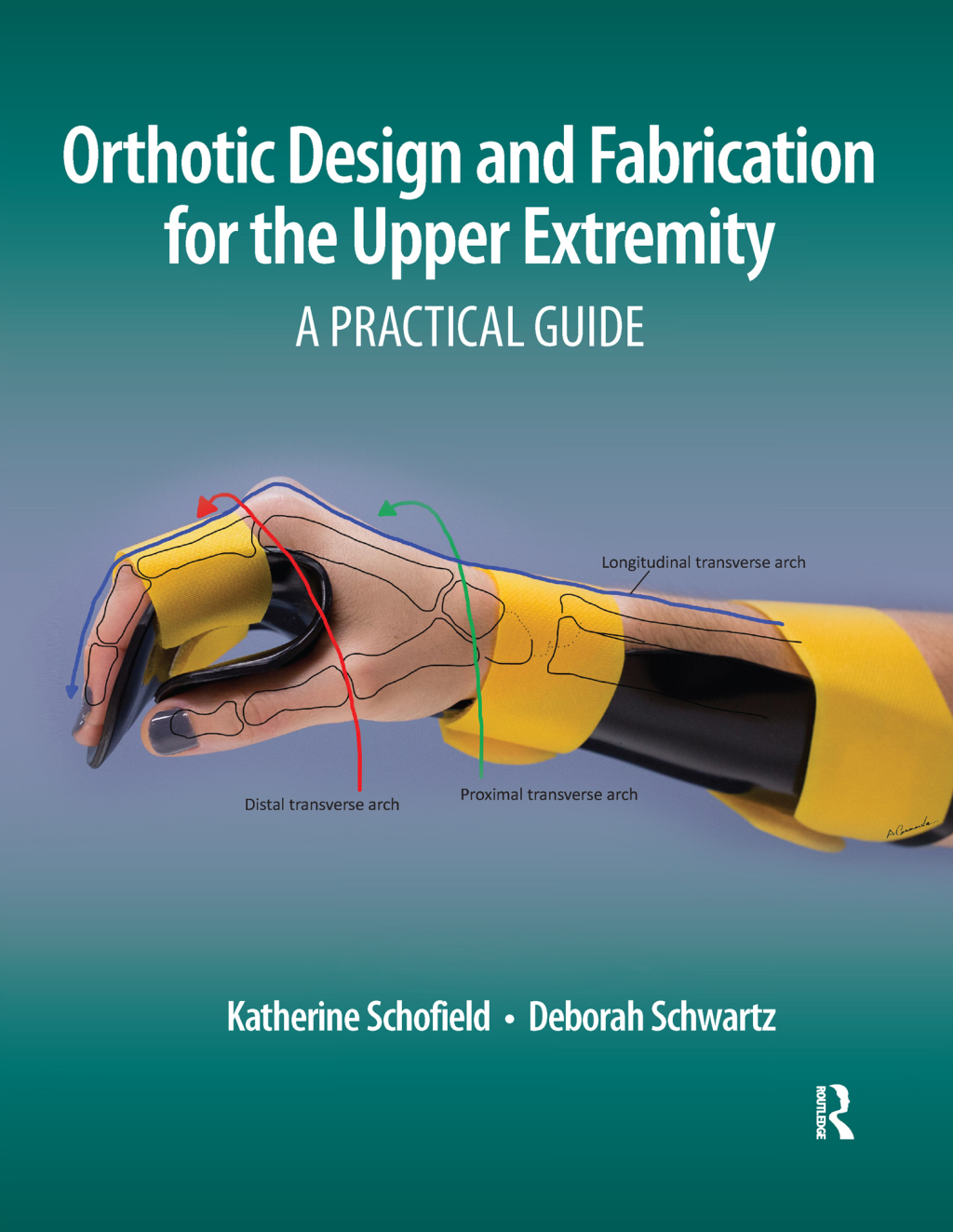 Orthotic Design and Fabrication for the Upper Extremity A Practical Guide 1st Edition â€“ PDF/EPUB Version Downloadable