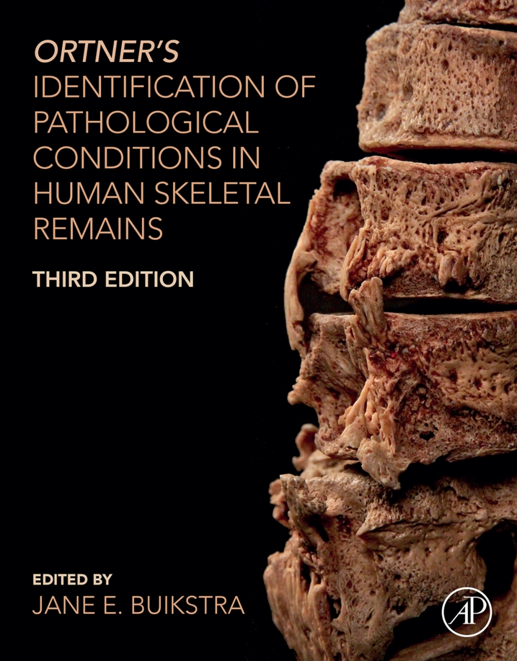 Ortner's Identification of Pathological Conditions in Human Skeletal Remains 3rd Edition â€“ PDF/EPUB Version Downloadable