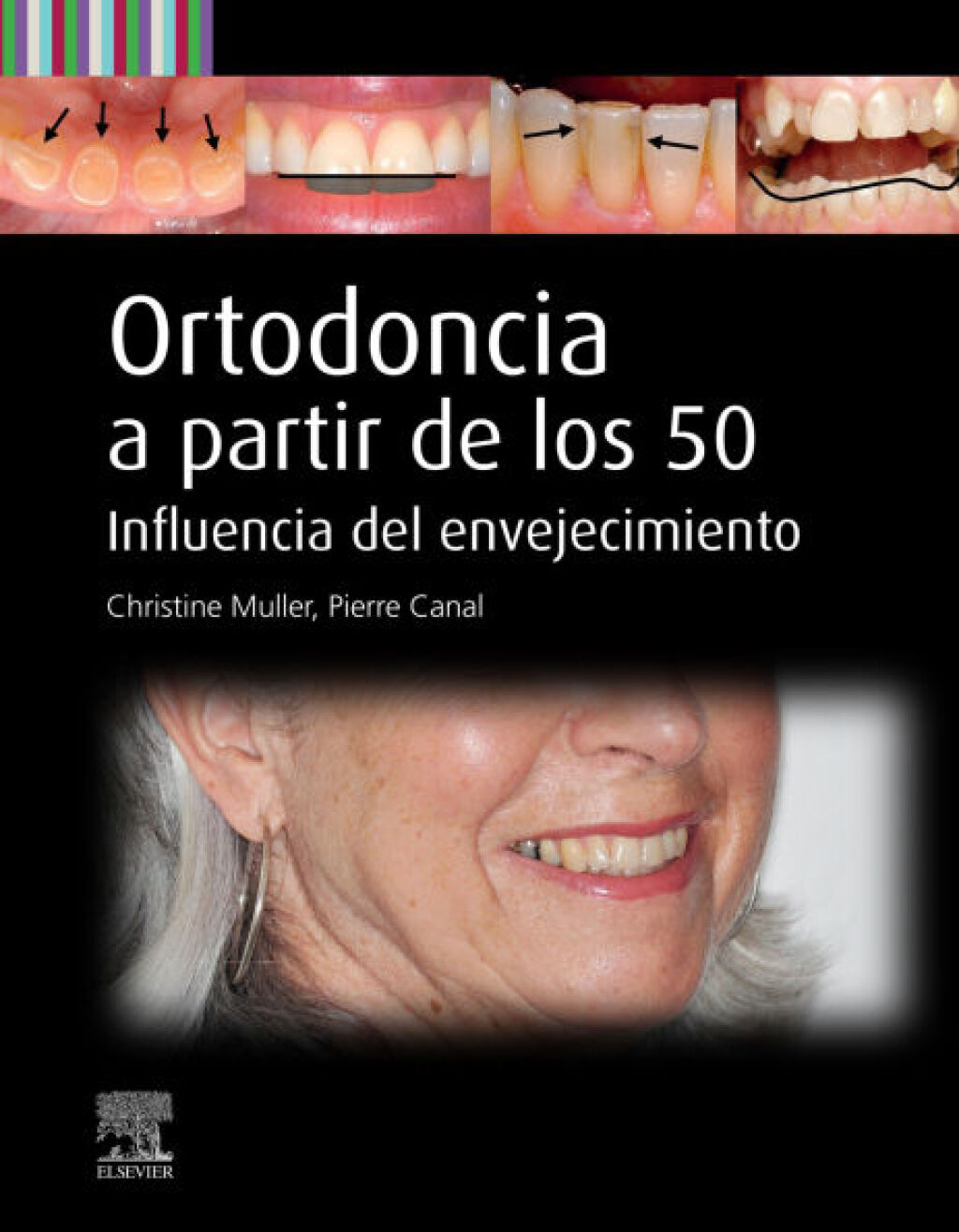 Ortodoncia a partir de los 50 Influencia del envejecimiento  â€“ PDF/EPUB Version Downloadable