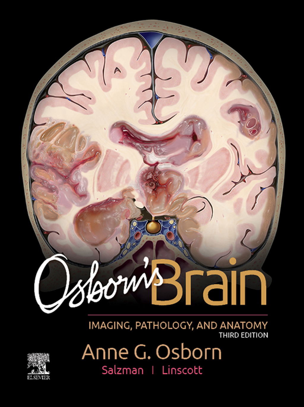 Osborn's Brain 3rd Edition â€“ PDF/EPUB Version Downloadable