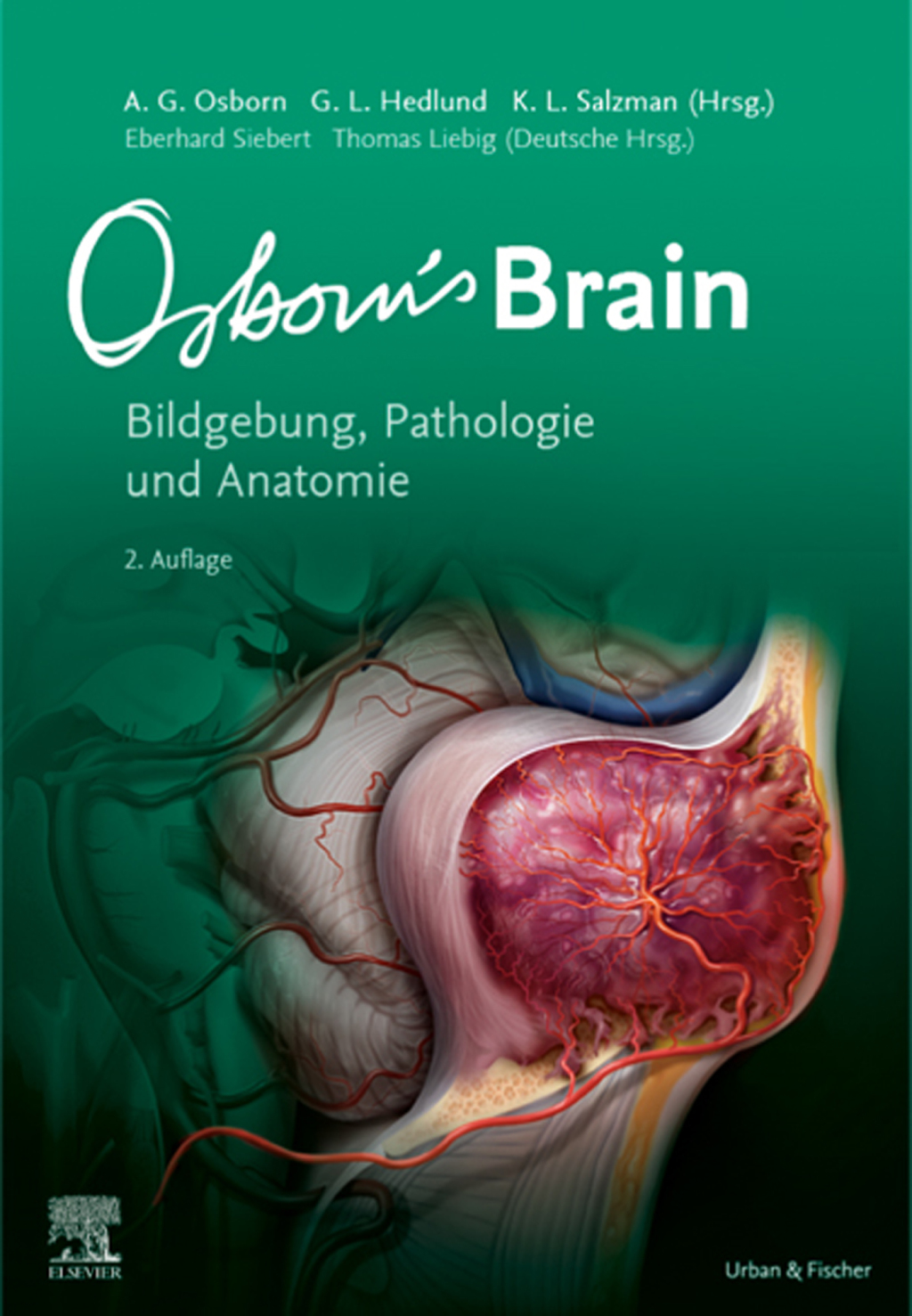 Osborn's Brain Bildgebung, Pathologie und Anatomie 2nd Edition â€“ PDF/EPUB Version Downloadable