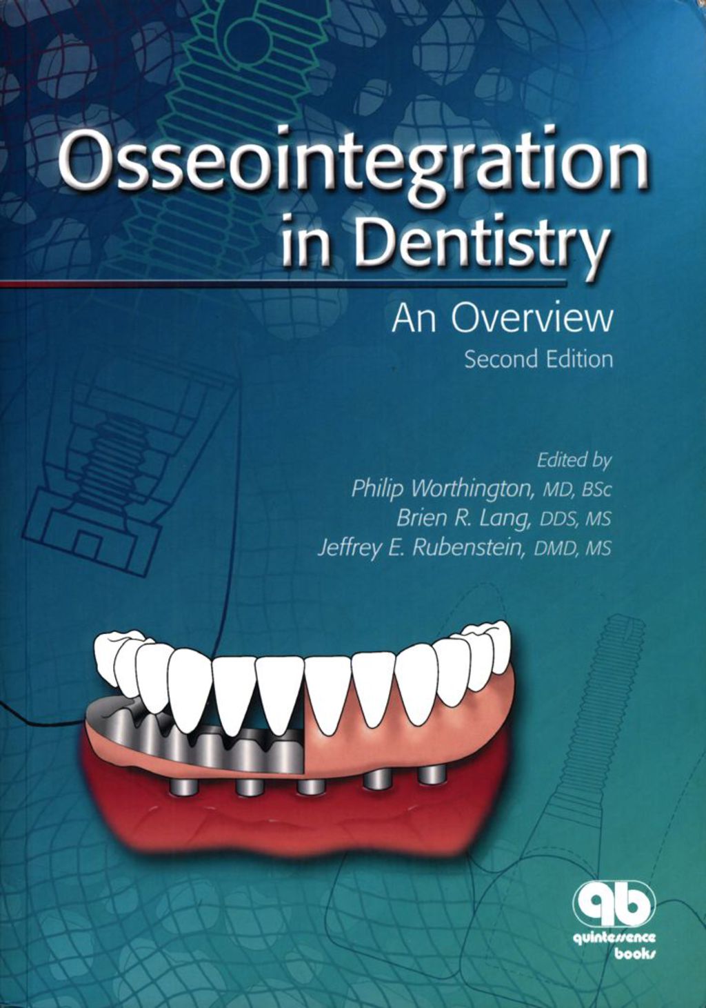 Osseointegration in Dentistry: An Overview, 2nd Edition 2nd Edition â€“ PDF/EPUB Version Downloadable