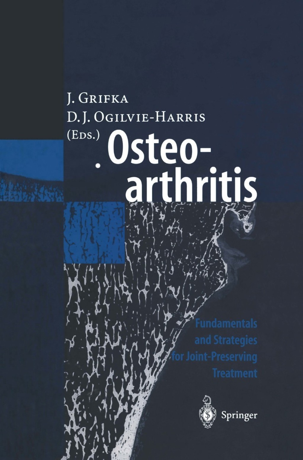 Osteoarthritis Fundamentals and Strategies for Joint-Preserving Treatment 1st Edition â€“ PDF/EPUB Version Downloadable