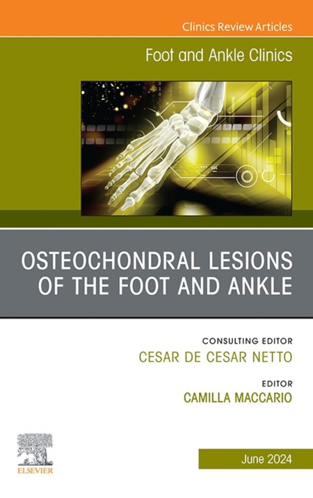 Osteochondral Lesions of the Foot and Ankle, An issue of Foot and Ankle Clinics of North America 1st Edition â€“ PDF/EPUB Version Downloadable