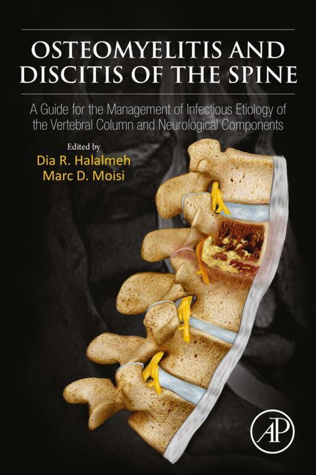 Osteomyelitis and Discitis of the Spine A Guide for the Management of Infectious Etiology of the Vertebral Column and Neurological Components  â€“ PDF/EPUB Version Downloadable