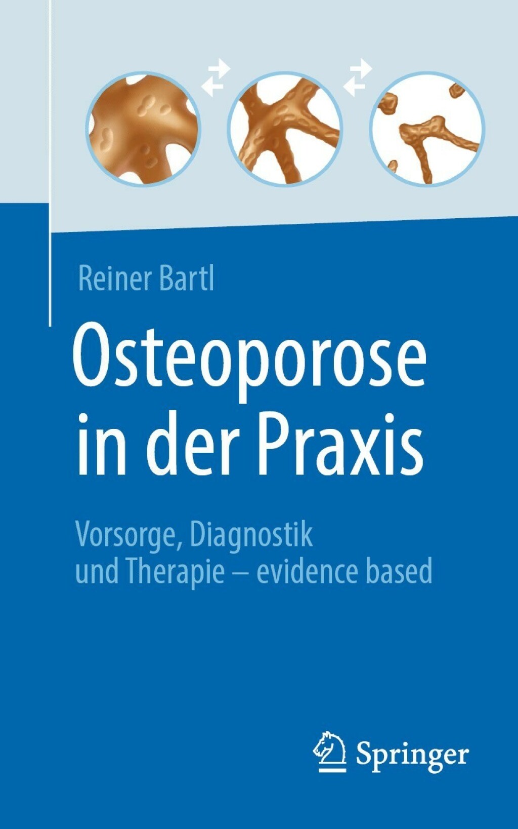 Osteoporose in der Praxis Vorsorge, Diagnostik und Therapie â€“ evidence based - (PDF/EPUB Version)