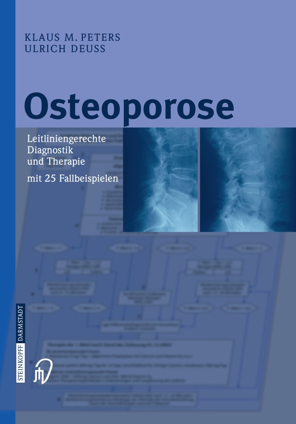 Osteoporose Leitliniengerechte Diagnostik und Therapie mit 25 Fallbeispielen  â€“ PDF/EPUB Version Downloadable