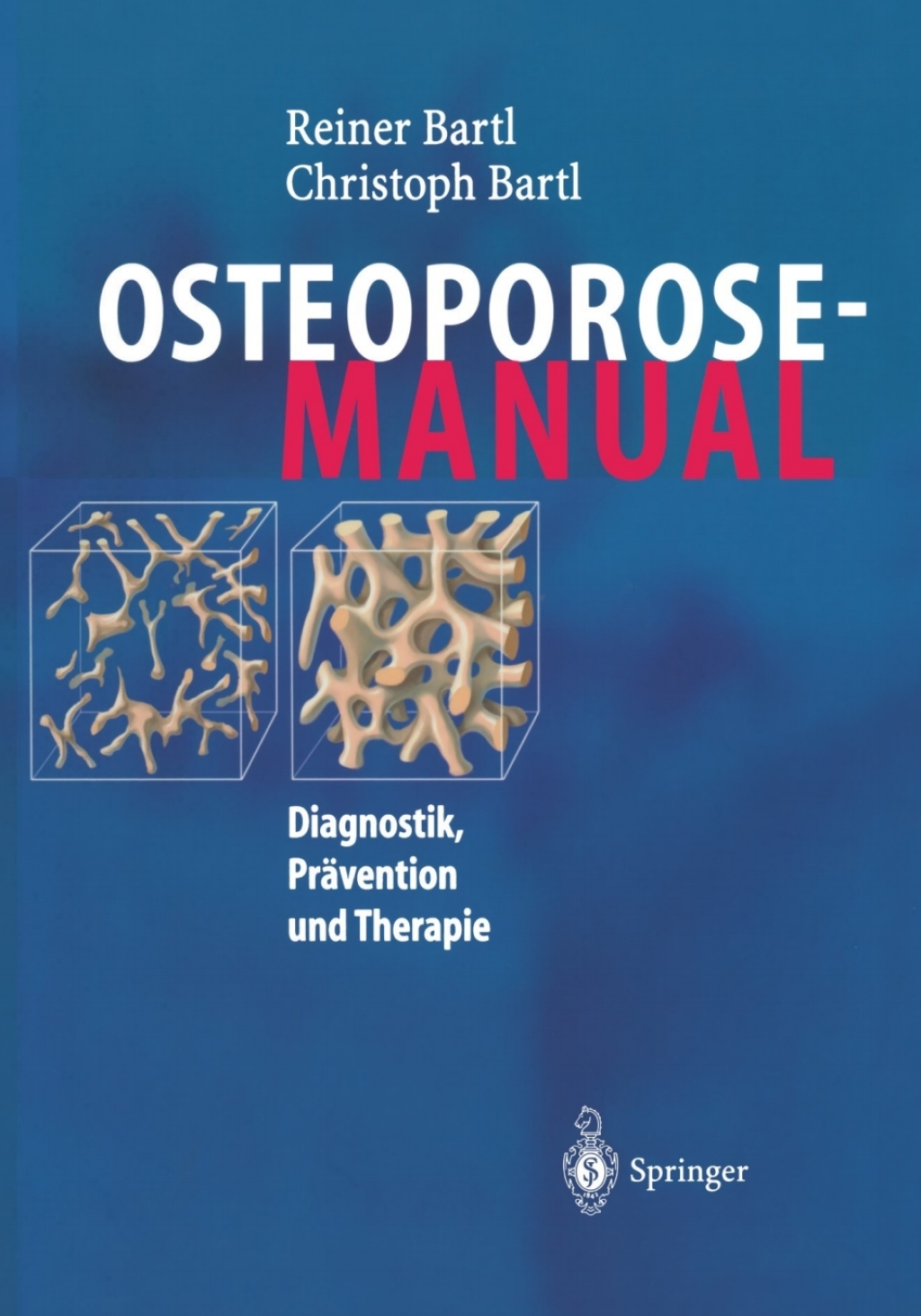 Osteoporose-Manual Diagnostik, PrÃ¤vention und Therapie  â€“ PDF/EPUB Version Downloadable