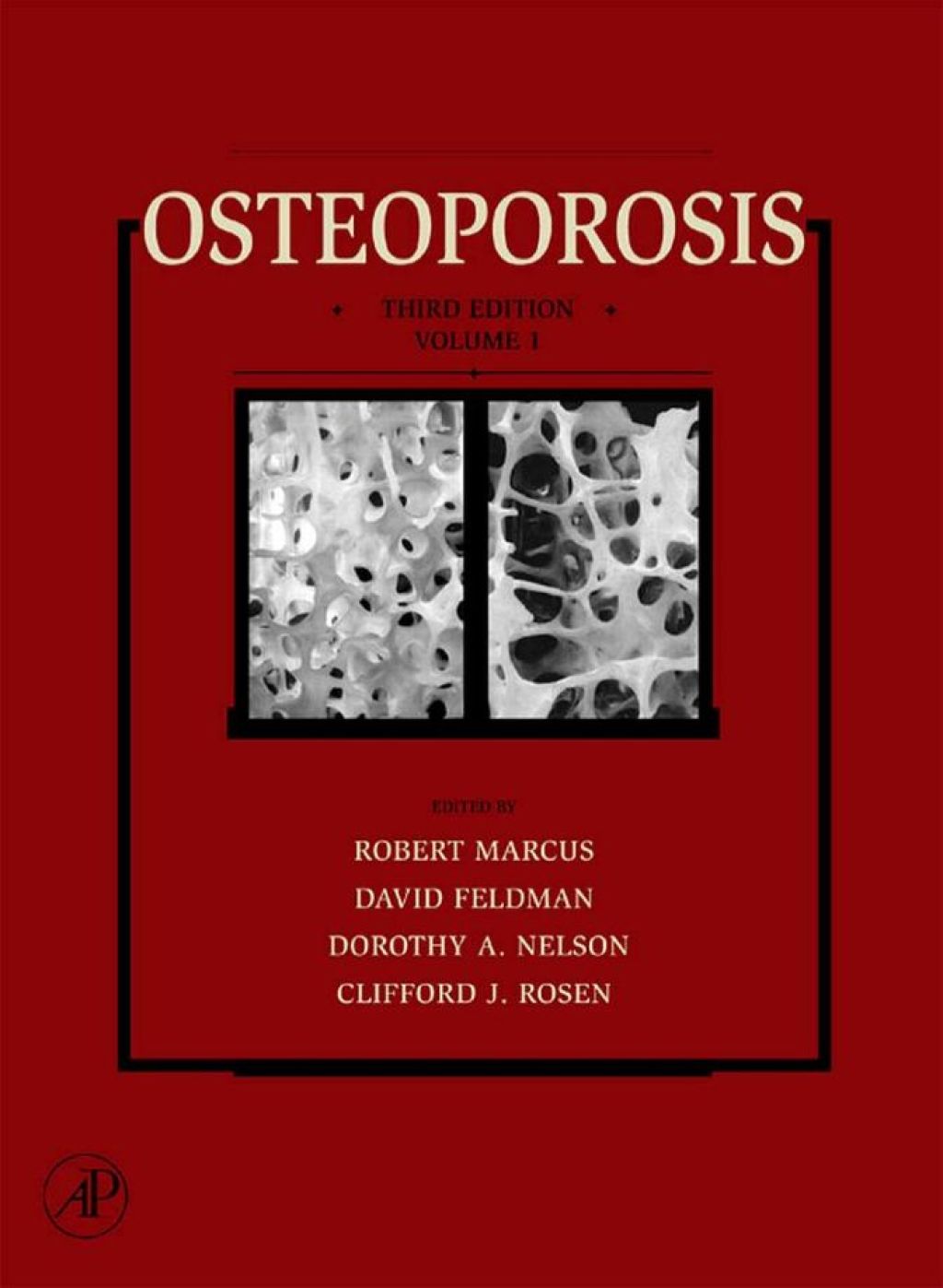 Osteoporosis 3rd Edition â€“ PDF/EPUB Version Downloadable